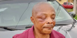 Human Rights Commission reacts to Brutality on NLC president, Ajaero, says act represents impunity